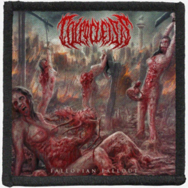 Colpocleisis - Fallopian Fallout