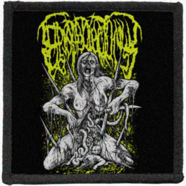 Epicardiectomy - printed patches