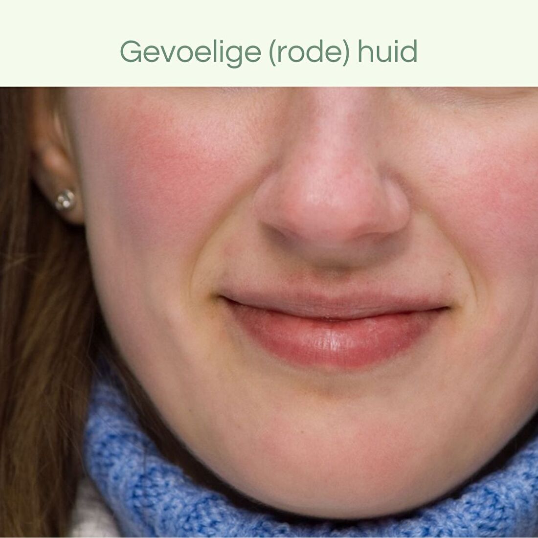 natuurlijke huidverzorging gevoelige huid