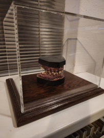 Nightmare on Elm Street 4 Lifesize Freddy Krueger Teeth Original Mold Movie Prop REPLICA