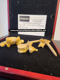 AMC The Walking Dead Original Production Used 3x Human Bones Set Movie Prop
