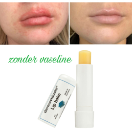 Dermaviduals® Lippenbalsem