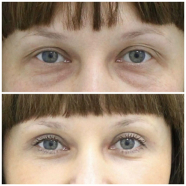 Minerale concealer