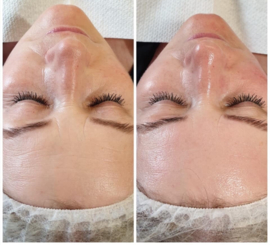 Stimulerende massageolie