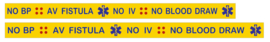 Polsbandje    AV FISTULA :: NO IV :: NO BP :: NO BLOOD DRAW