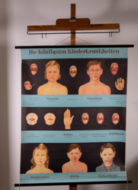 Kinderziektes