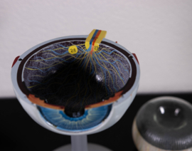 OOG