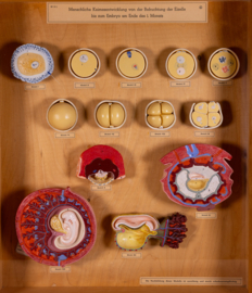 Vintage oude school vitrine kast  - Zwangerschap 1   .
