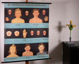 Kinderziektes