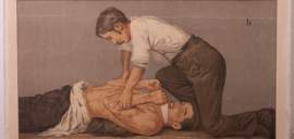 Kunstmatige ademhaling