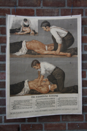 Kunstmatige ademhaling