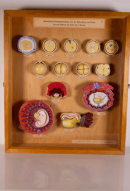 Vintage oude school vitrine kast  - Zwangerschap 1   .