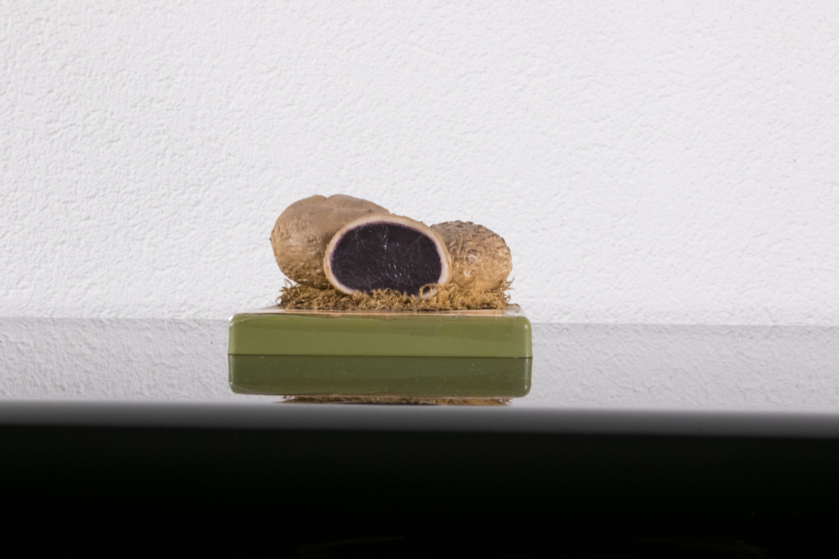 Sclederma Vulgare