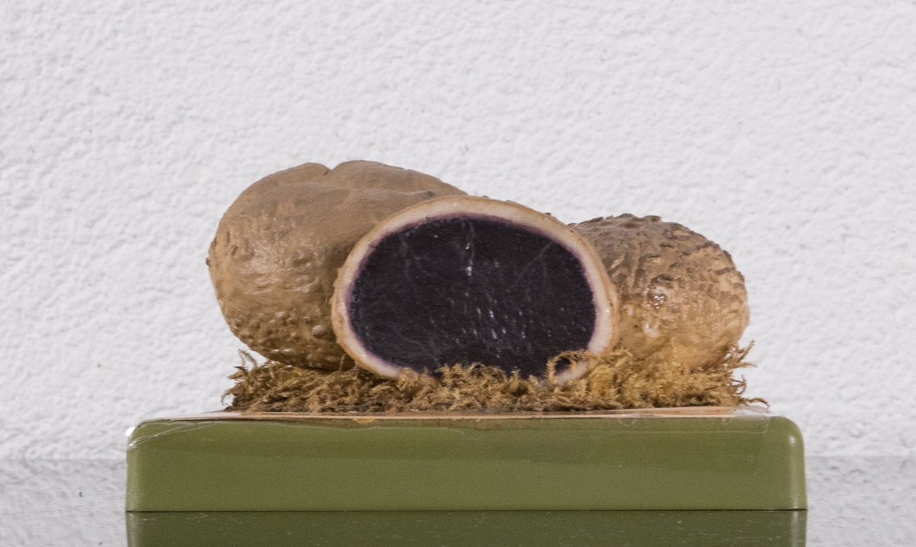 Sclederma Vulgare