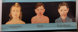 Kinderziektes