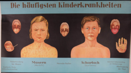 Kinderziektes