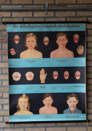 Kinderziektes