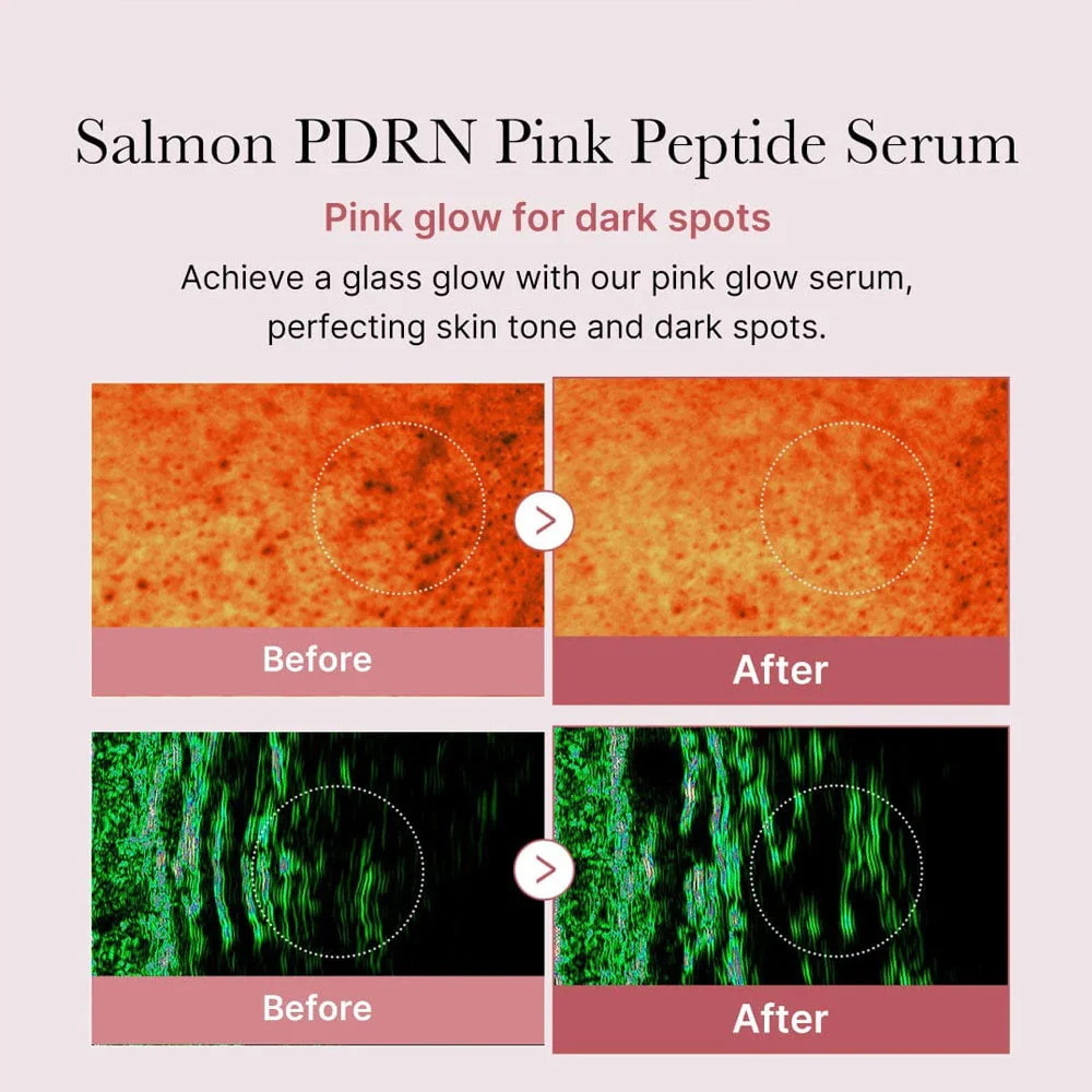 Medicube - PDRN Pink Peptide Serum (30ml)