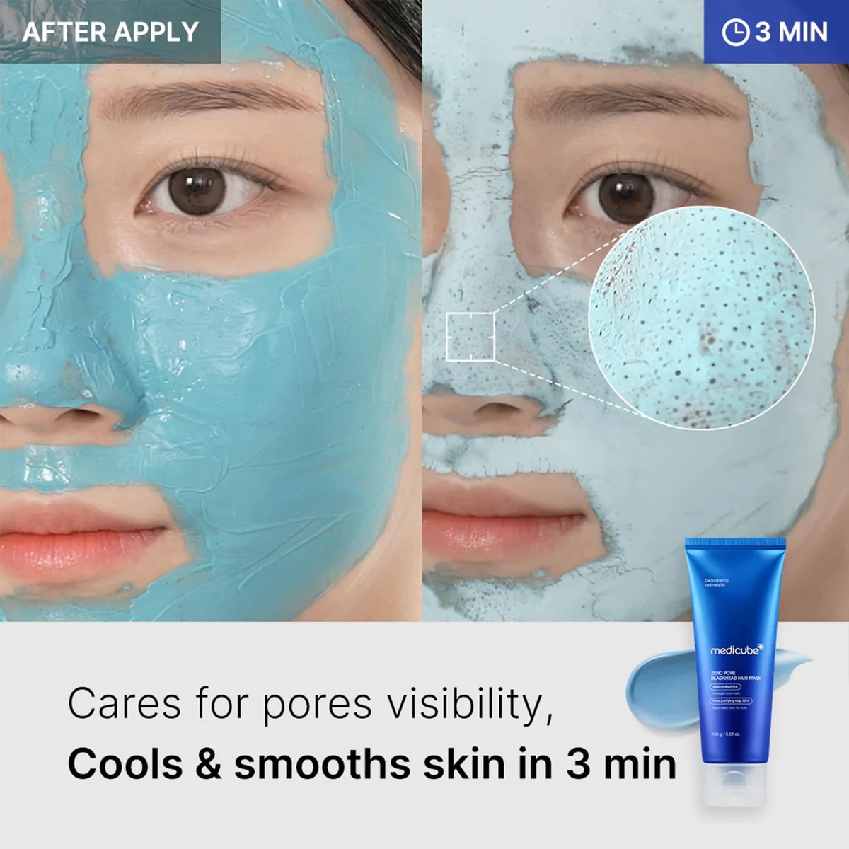Medicube - Zero Pore Blackhead Mud Mask (100g)