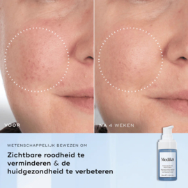 Medik 8 Niacinamide Peptides (30ml)