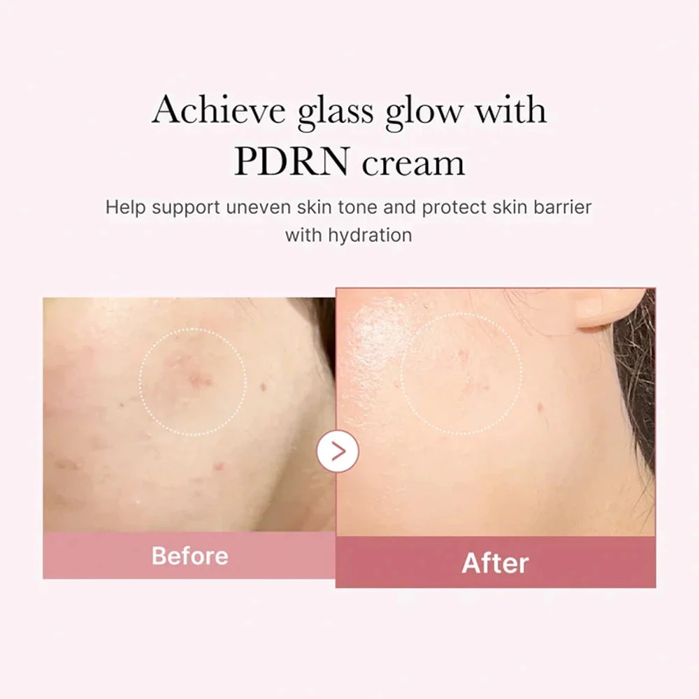 Medicube - PDRN Pink Hyaluronic Moisturizing Cream (50ml)