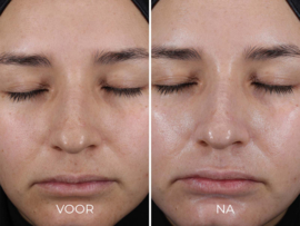 NIEUW - Daily Prevention Pure Mineral Hydrating Moisturizer SPF 30 (77ml)