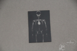 Röntgenfoto lichaam