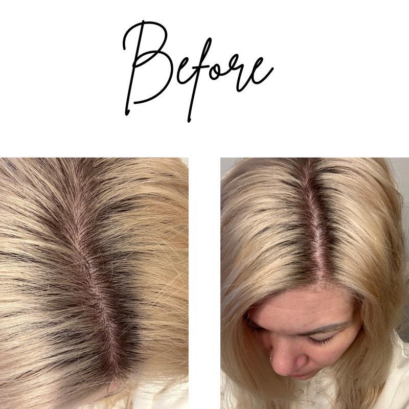 voor de Nº.0.5 Scalp Longevity Treatment behandeling