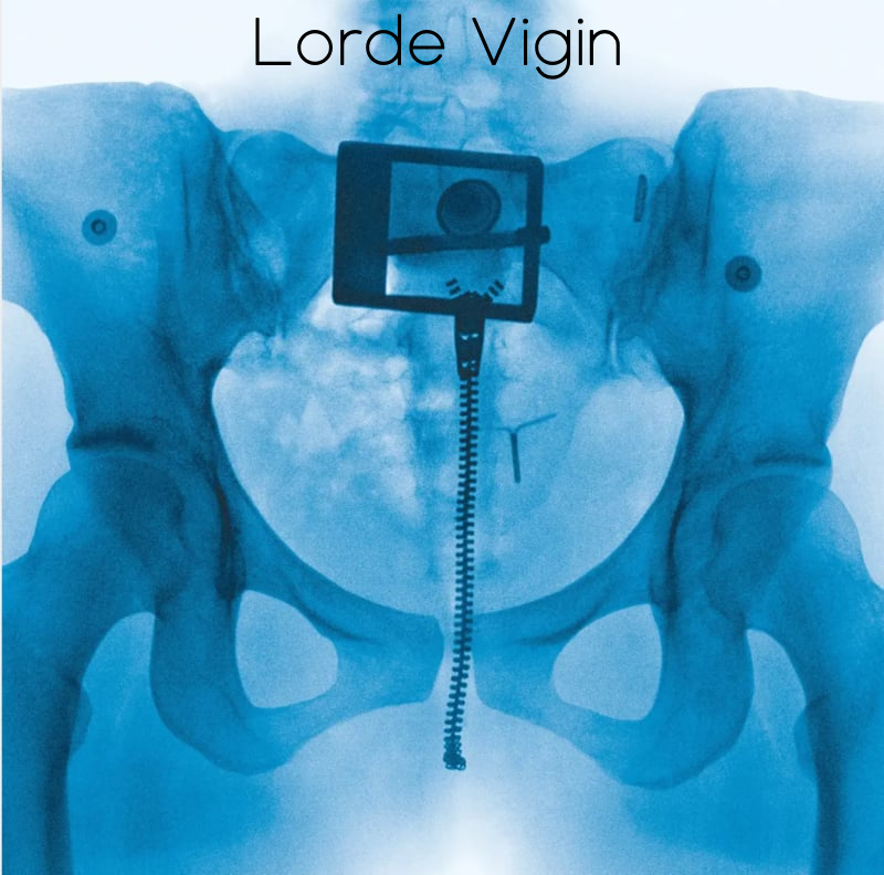 Lorde Virgin LP