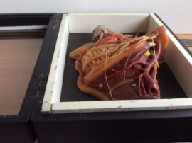 Wax Medical teaching aid (1910)