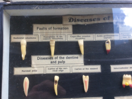 Tanden, Diseases of the teeth (Nr. 1)