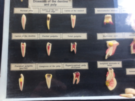 Tanden, Diseases of the teeth (Nr. 1)