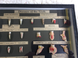 Tanden, Diseases of the teeth  (Nr. 2)