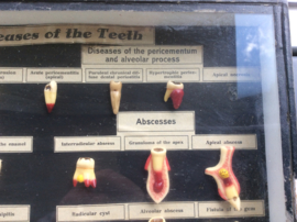Tanden, Diseases of the teeth (Nr. 1)