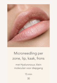 Microneedling per zone, lip, kaak, frons