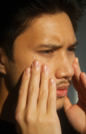 Beste middel tegen Acne