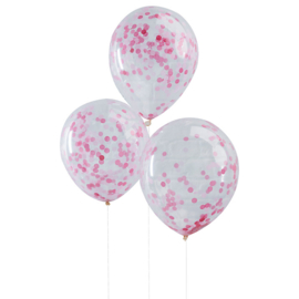 Confetti ballonnen roze (5st)