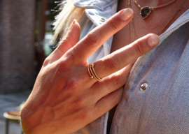 Niessing ring Embrace
