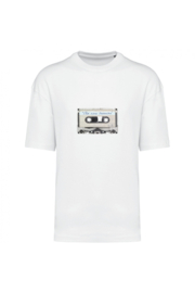 Musikkassette
