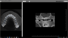 Mediadent v8 3D Viewer Module