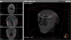 Mediadent v8 3D Viewer Module