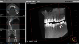 Mediadent v8 3D Viewer Module