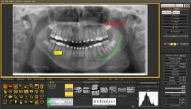 Mediadent v8 multi user licentie