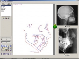 D.F.O. Ortho Multi-user licentie