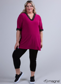 Wide Lace Detail A-Line Shirt (B-2423) 056SQR-Magenta Square