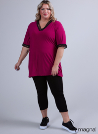 Wide Lace Detail A-Line Shirt (B-2423) 056SQR-Magenta Square