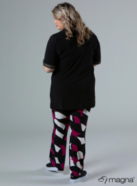 Wide Lace Detail A-Line Shirt (B-2423) 001SQR-Black Square