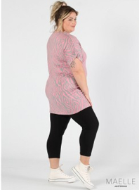 Oversized Shirt (ME-TU-1015) Y-02005-Graphical Zebra Pink