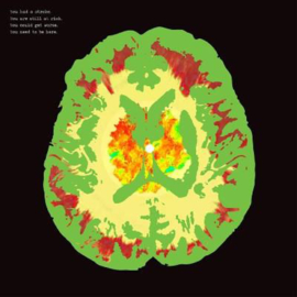 Minus 5 ‎– Stroke Manor | LP -coloured vinyl-