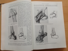 Pakket a 6 delen Chirurgische Operationslehre - Bier / Braun / Kümmell